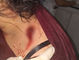 La mujer sufrió una herida cerca del hombro. Foto: Gentileza.
