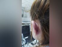 Una prueba de la golpiza que sufrió la joven de parte de su expareja. Foto: Gentileza.